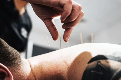 The Ultimate Healing Powers: 9 Benefits of Acupuncture