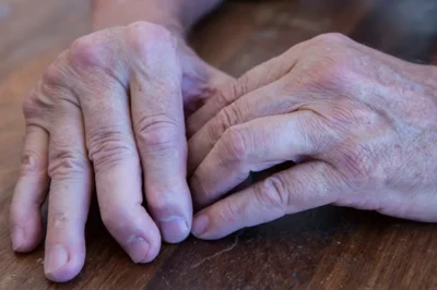 7 Natural Remedies for Arthritis Relief and Ultimate Comfort